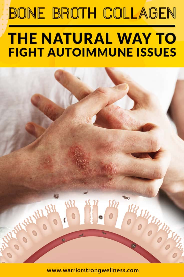 bone broth collagen, Autoimmune Issues