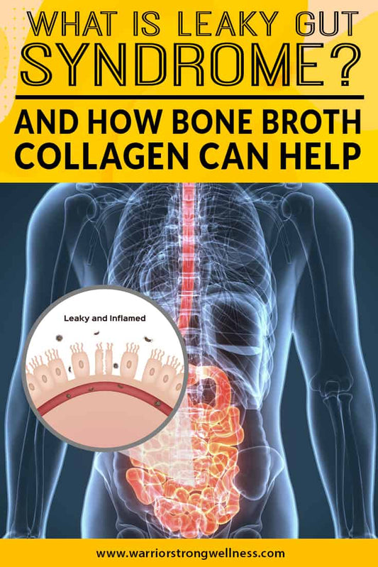 Leaky Gut Syndrome, Collagen Peptides & Bone Broth